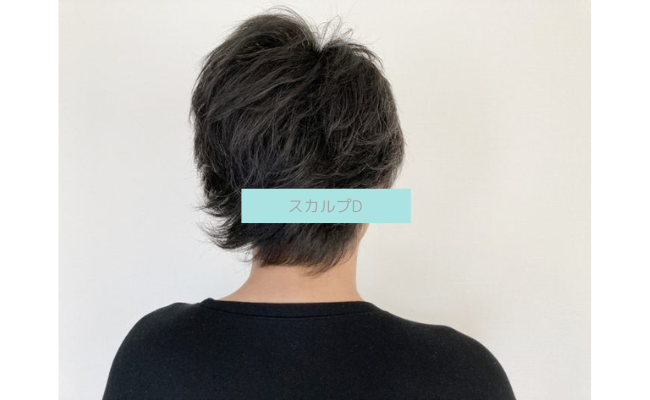 scalp-d12