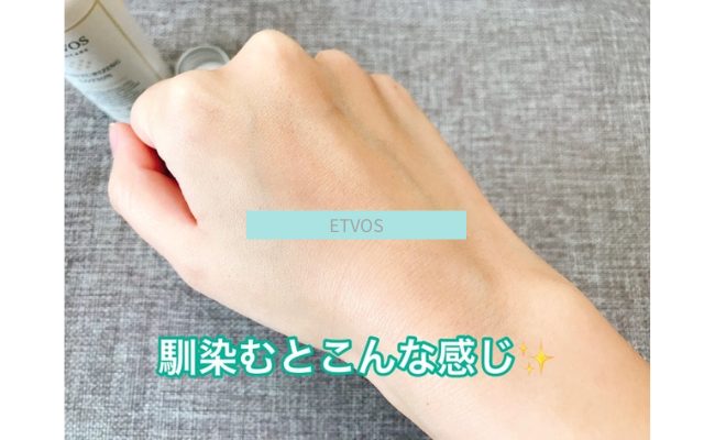 etvos13