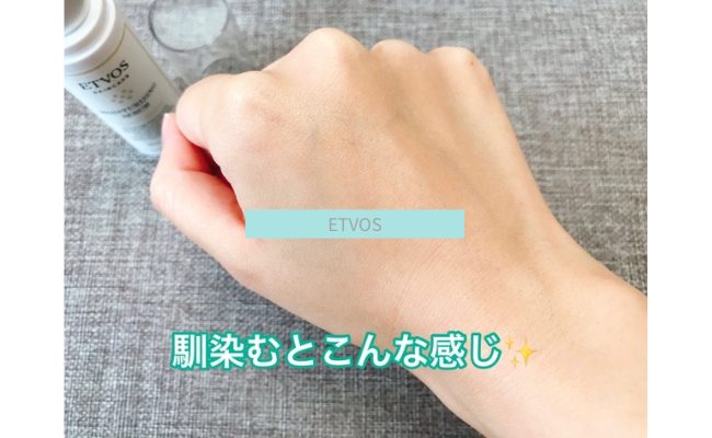etvos17