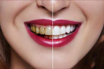 【評判は?】シシュテックを試した私が感じた効果と口コミ体験談!⑥