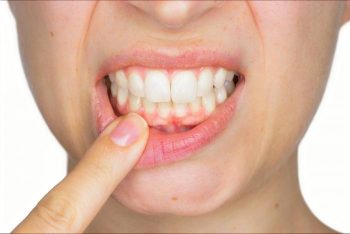 【評判は?】シシュテックを試した私が感じた効果と口コミ体験談!⑧